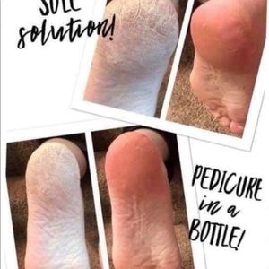 Sole Solution